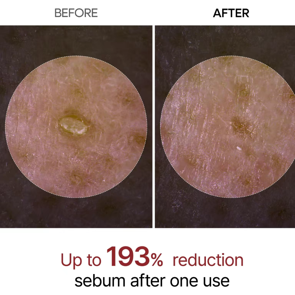 VIRAL Peel Shot Serum Set (Toner + Exfoliant)